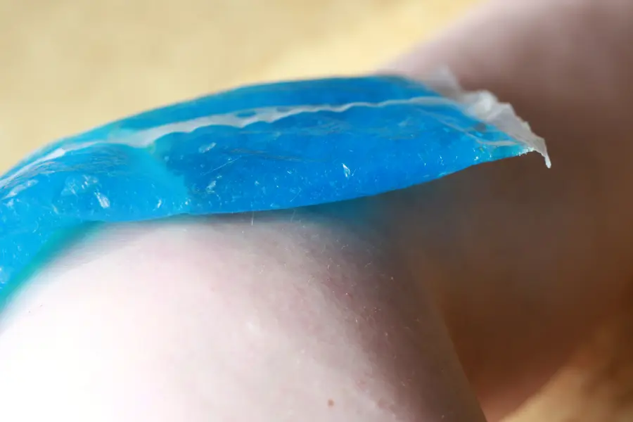 Rabatte Coupon Nahaufnahme eines Arms mit einem blauen Kühlpad auf der Haut – zur Linderung von Juckreiz nach einem Mückenstich.